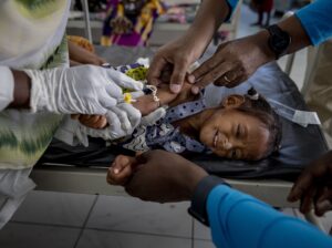 Port Sudan, Sudan. Doctors worked to place a new intravenous cannula in the arm of Bara’a Ahmed at the malnutrition centre at Port Sudan Paediatric Teaching Hospital. Although undiagnosed at the time, Bara’a was also suffering from Cholera and doctors were not sure she would survive. Two weeks later she was said to be responding well to treatment and likely to live.